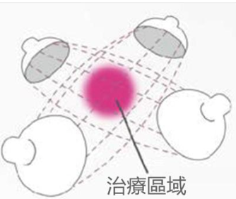 2025全新 YOUNG-IN 2400 干擾波電流治療儀 IN-2200 進階版本 韓國製造